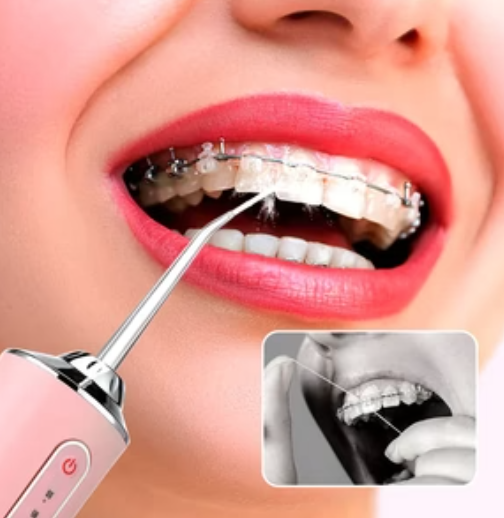 Irrigador Dental Inalámbrico 360